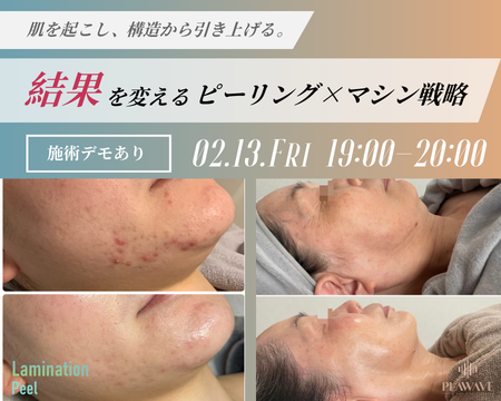 【施術デモあり】肌を起こし、構造から引き上げる。結果を変えるピーリング×マシン戦略